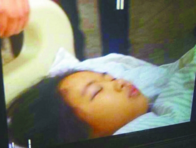 长春被撞女中学生恢复意识 系128路违章超车造成事故
