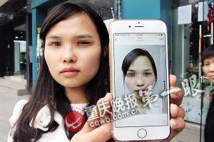 美女割双眼皮被整成高低眉 医院:我觉得很好