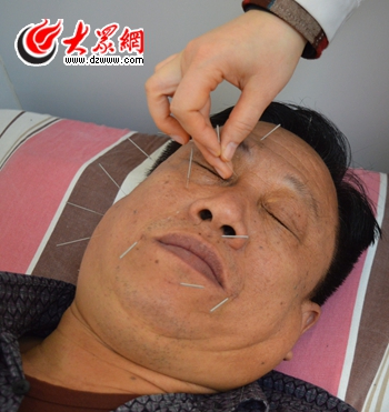 中风老汉“灸”一个月想扔拐 记者体验神奇针灸