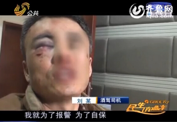 济南：酒后斗殴被打满脸伤痕 男子酒驾求救警察