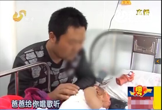 枣庄一岁男婴被滚烫热水从头浇下 大面积严重烫伤