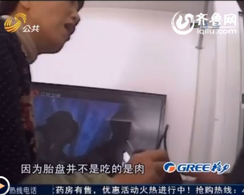 烟台某公司买卖胎盘 现场风干加工制胶囊