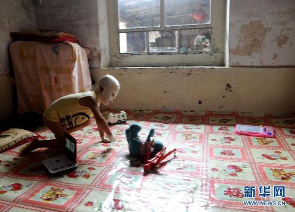 山西汾阳面具娃娃在京治疗后回家养伤(组图
