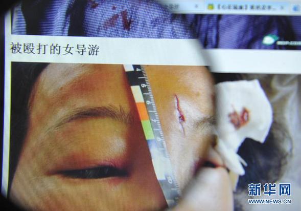 安徽黄山:一富家子弟殴打女导游引发争议
