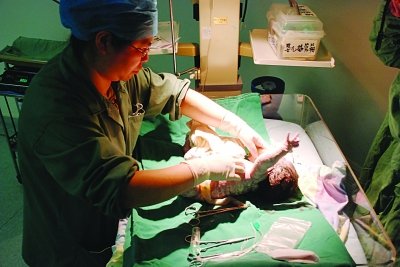 产妇扎堆9月1日前剖腹生子 医生称赶日子风险大