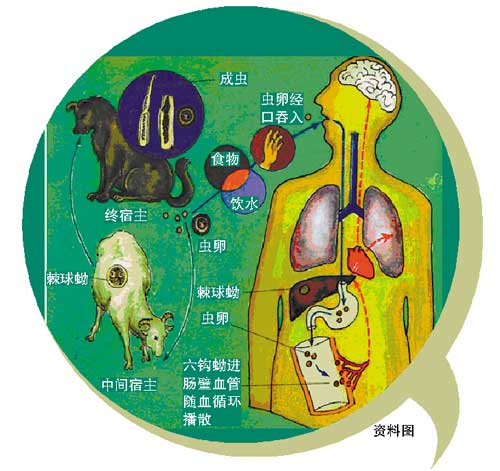 少女长期与宠物睡觉 遭“宠物虫”噬骨导致瘫痪