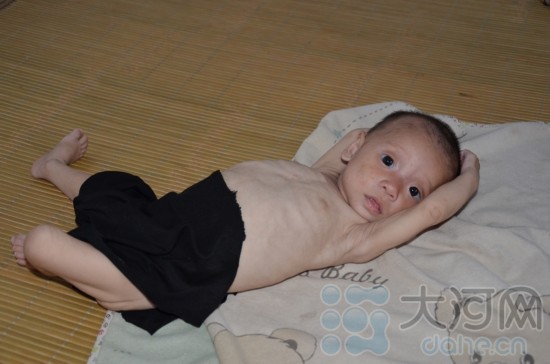 “饥饿娃娃”取名常笑 家乡政府连夜研究救济措施