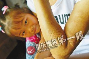 妙龄女自幼患病面容似老太全身皮肤松弛(图)