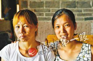 妙龄女自幼患病面容似老太全身皮肤松弛(图)