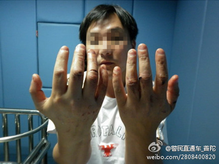 男子车被挡道用拳头 怒砸15辆车