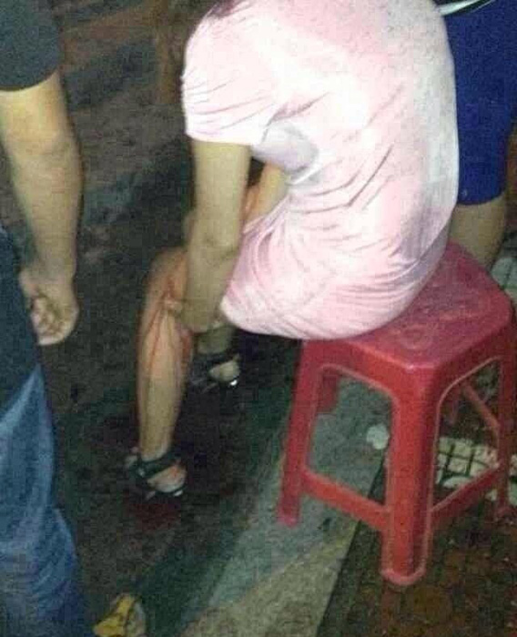 福建发生多起路人遭割肉事件 嫌疑人已被抓获