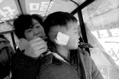 湖北男童遭二婶割双耳续：家里没钱暂时出院