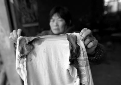 湖北男童遭二婶割双耳续：家里没钱暂时出院
