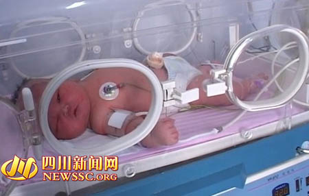 南充高龄产妇产下12.5斤重巨婴 占满保育箱