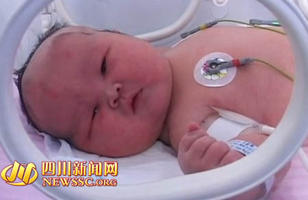 南充高龄产妇产下12.5斤重巨婴 占满保育箱
