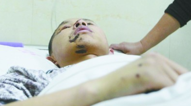 准新娘马路上拍婚纱照被撞致重度昏迷(图)