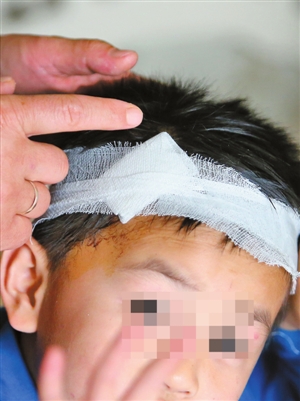 洗澡时钢化玻璃爆炸 深圳六岁男孩身上十几处割伤
