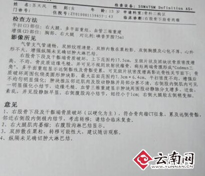 鲁甸女孩患恶性骨肉瘤将截去右腿 10万医疗费愁煞单亲之家