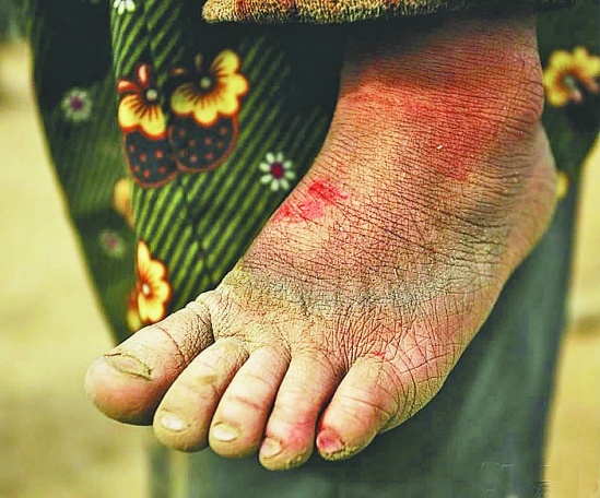 新昌：寒冬里的砖窑“花朵”