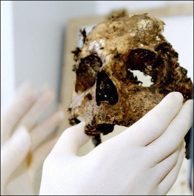 A paleopathologist inspects the decomposed remains of a human skull.