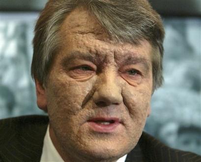 poisoned viktor yushchenko