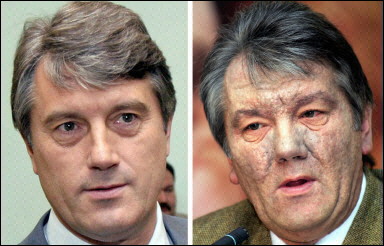 Ukrainian opposition leader Viktor Yushchenko pictured in July (L) and December. Yushchenko said he was not yet ready to blame the ruling elite with trying to poison him after doctors confirmed he was disfigured by ingesting a massive dose of a deadly toxin. [AFP]