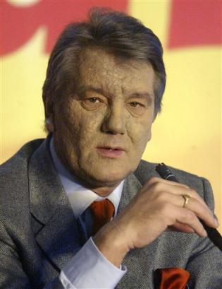 Ukrainian opposition presidential candidate Viktor Yushchenko speaks to the media during a press conference in Kiev, Ukraine, Friday, Dec. 24, 2004. Yushchenko said Friday that his top priority if he wins this weekend's rerun election will be to heal divisions within society. [AP]