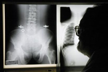 Kodak research associate Phillip Bunch looks over the new X-ray film he and co-inventor Robert Dickerson developed, which cuts a patient's radiation exposure by about 50 percent, while in an office in Rochester, N.Y., Wednesday, March 9, 2005. [AP]