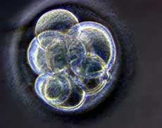 A handout photograph published May 19, 2005, shows a cloned human embryo, created at the Centre for Life in Newcastle upon Tyne, England, three days after the nuclear transfer took place. Legislation that would loosen restrictions on government funding of embryonic stem cell research headed for debate in the House of Representatives on May 24 under a veto threat from President Bush. Bush, who has yet to veto a bill during his presidency, planned to join the debate from the White House with a speech about why the government should stick with his policy. (Reuters 