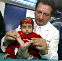 'Mermaid' baby to begin 15 years of surgery