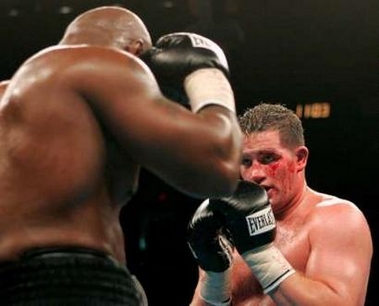 Irishman Kevin McBride (R), with blood streaming down his face from a cut caused by a head butt, watches former heavyweight champion Mike Tyson during their heavyweight fight at MCI Center in Washington June 11, 2005. Tyson's corner asked the referee to stop the fight at the end of the sixth round giving McBride the victory. REUTERS
