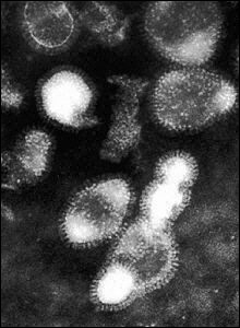 Microscopic view of the H5N1 virus. A British laboratory that tested a sample of a bird flu virus found in Romania confirmed that it is the the H5N1 strain that has killed more than 60 people in Asia.(AFP/File) 