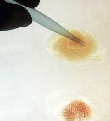 A virologist observes the result of a rapid heamagglutination test for bird flu identification at Portugal's Veterinarian Institute in Lisbon November 8, 2005. The sample at the bottom shows a positive test for bird flu. The sample on top shows a negative test.