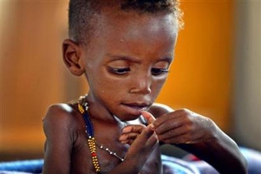 A severely malnourished girl is seen in the town of Tahoua in northwestern Niger, August 2, 2005.