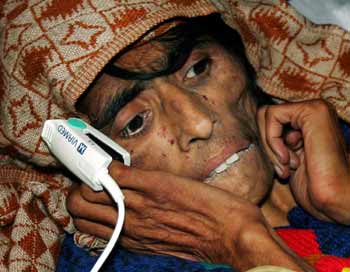 A Kashmiri earthquake survivor lies in a hospital in Muzaffarabad in Pakistan-administered Kashmir December 12, 2005. The woman was rescued from the rubble after more than two months in Kamsar Camp near Muzaffarabad on Monday, local media reported.
