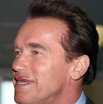 Arnold Schwarzenegger back to work after injury