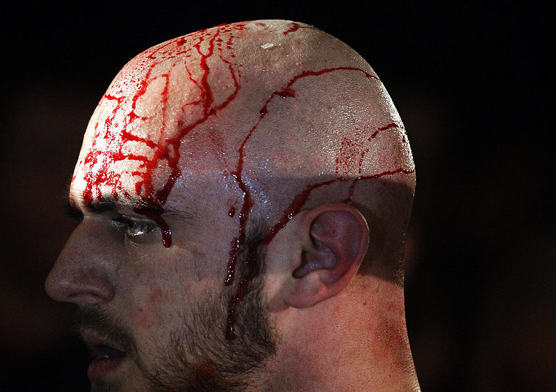 Wrestler Dover leaves from the ring after he fell on three nails during his fight against wrestler Renegade during the Hungarian wrestling Championship in Budapest, on Feb 25, 2012. About 200 nails were thrown on the ring as part of the show. 2012 Sports Photos in Review: Accidents on the court