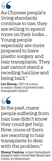 Hair transplants growing in popularity