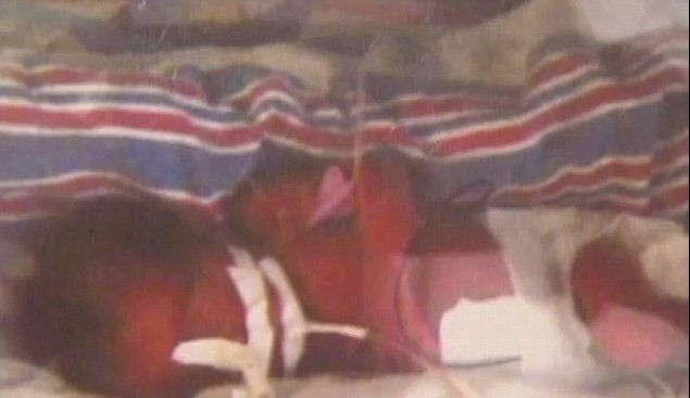 美孕妇脑死亡42天后产下双胞胎男婴 用尽最后力气让孩子出生