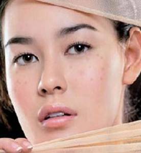 祛斑霜排行榜 淘宝祛斑霜排行榜