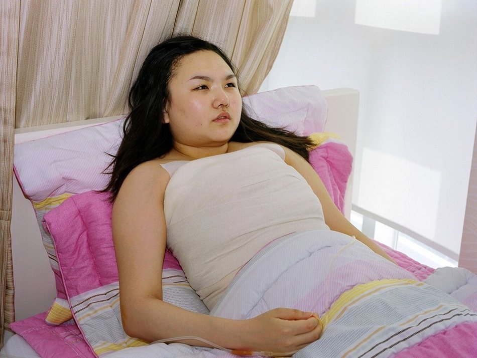 韩国女子整容术后的生活（组图）