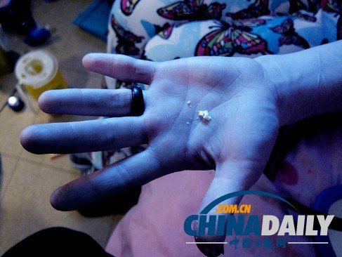 美丽蜕变！实拍吸毒女孩的戒毒历程