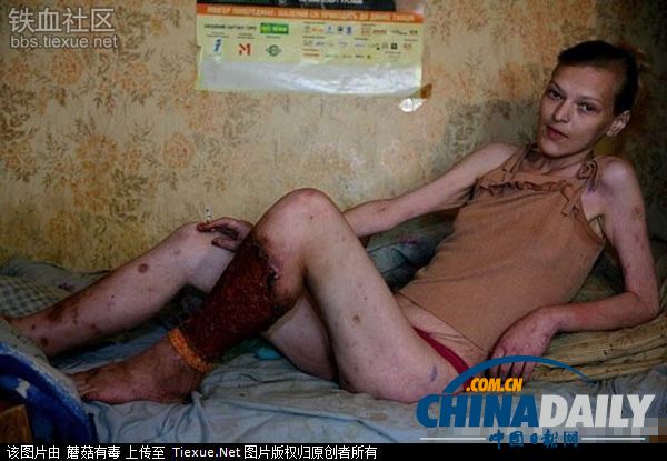 美丽蜕变!实拍吸毒女孩的戒毒历程