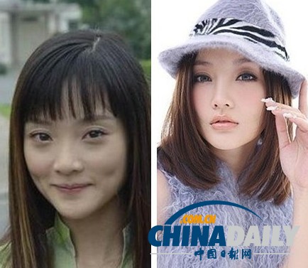 柳岩李小璐杨幂 女星整容前惊人对比照