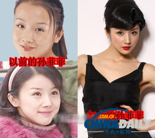 柳岩李小璐杨幂 女星整容前惊人对比照
