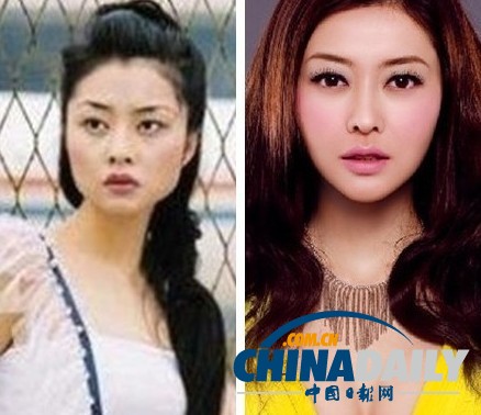 柳岩李小璐杨幂 女星整容前惊人对比照