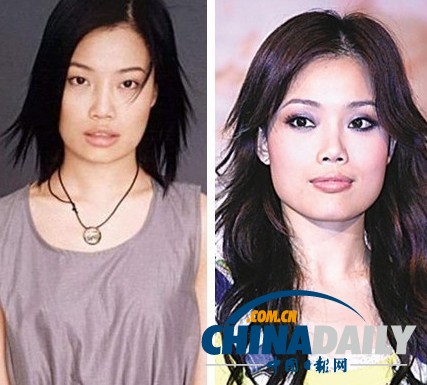 柳岩李小璐杨幂 女星整容前惊人对比照