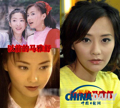 柳岩李小璐杨幂 女星整容前惊人对比照