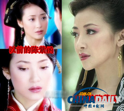 柳岩李小璐杨幂 女星整容前惊人对比照