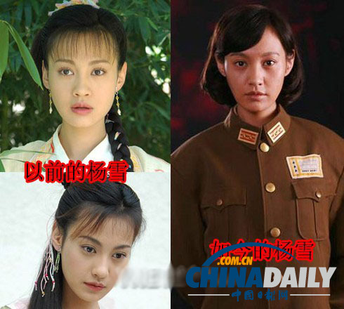 柳岩李小璐杨幂 女星整容前惊人对比照